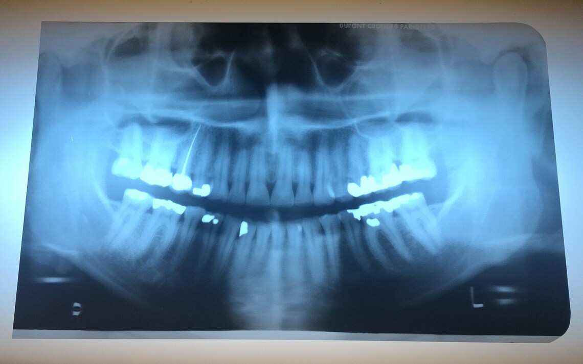 Vintage Dental Xray Films Panoramic Etsy
