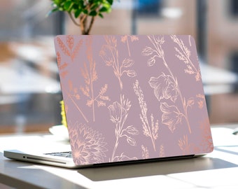 Pink Marble Laptop Skin Floral Notebook Vinyl Decal Dell Hp Lenovo Asus Chromebook Acer Laptop Decal Cover Skin For Any Laptop Sticker
