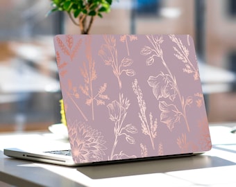 Pink Marble Laptop Skin Floral Notebook Vinyl Decal Dell Hp Lenovo Asus  Chromebook Acer Laptop Decal Cover Skin For Any Laptop Sticker