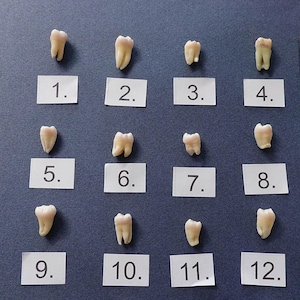 Könnte beinhalten: Sechzehn einzelne menschliche Zähne, angeordnet in einem vier-mal-vier Raster, jeweils mit einem weißen Papieretikett versehen, das von 1 bis 16 nummeriert ist. Ein Metalllineal an der rechten Seite dient als Skala in Zentimetern.