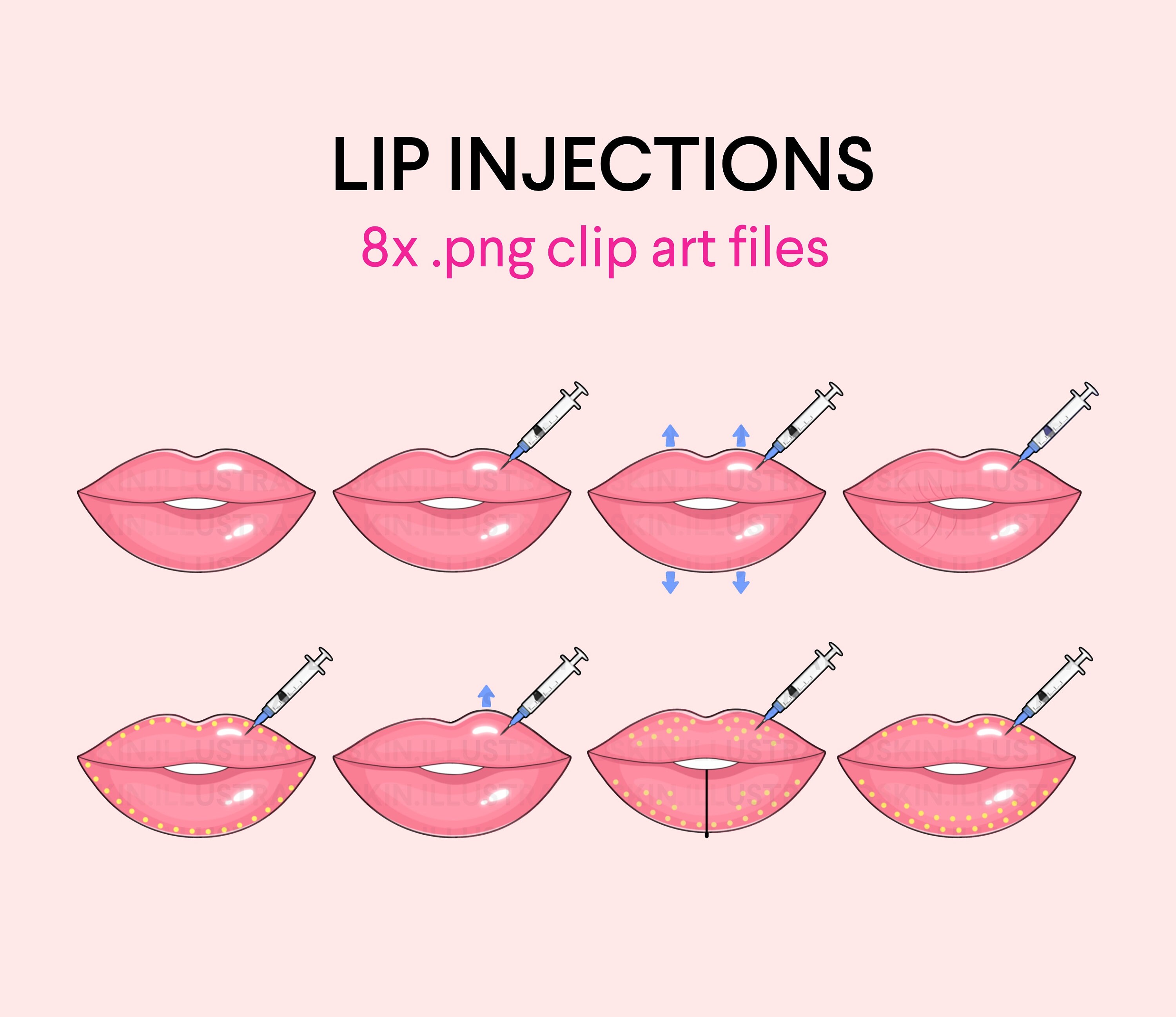 Lip Mapping Injections Clipart Pack | aesthetic injector, fillers, cosmetic medspa