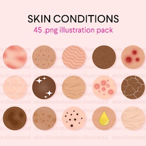 ESTHETICIAN Skin Problems Icon Pack | Esthetician Illustration