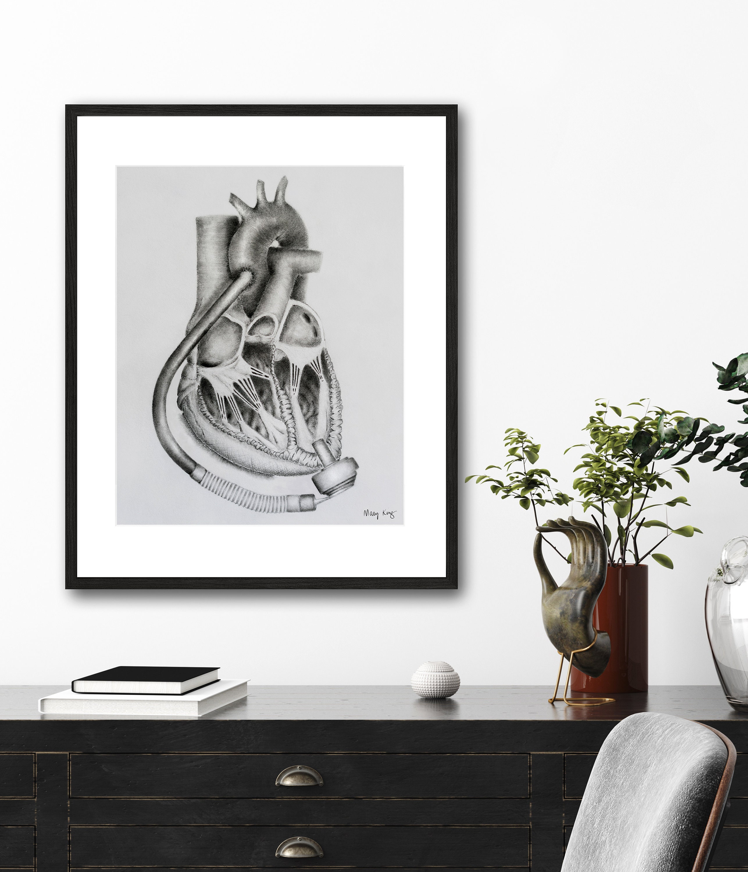 Heartmate 3 Lvad Etsy