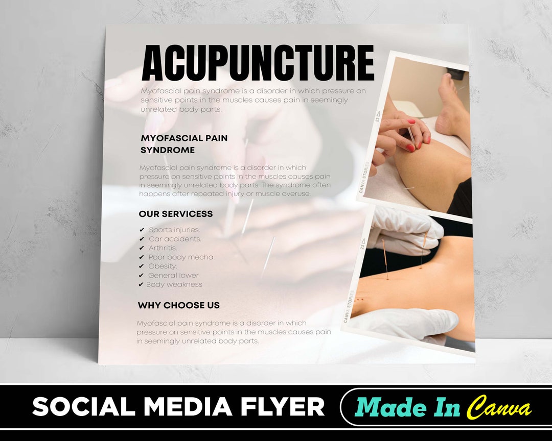 Acupuncture Flyer DIY Canva Acupuncture Flyer Template 2022 Etsy UK