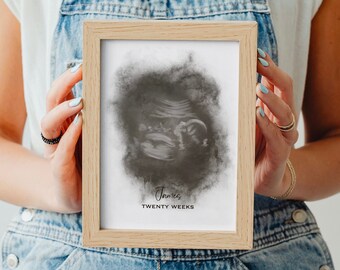 Custom Baby Sonogram Art, Personalised Gender Reveal Print, Ultrasound Fetal Watercolor Drawing, Embryo Digital Illustration, IVF Fertility