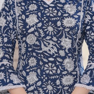 May include: A navy blue floral print top with white accents. The long-sleeved top features a V-neck and white lace trim along the neckline and sleeves. The floral pattern is a repeating design of white flowers and leaves.