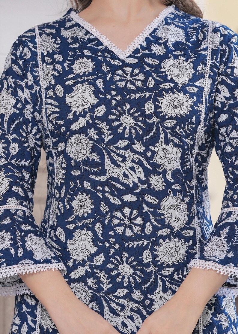 May include: A navy blue floral print top with white accents. The long-sleeved top features a V-neck and white lace trim along the neckline and sleeves. The floral pattern is a repeating design of white flowers and leaves.