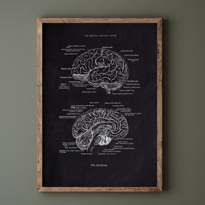 Può includere: Una stampa incorniciata con una dettagliata illustrazione anatomica del cervello umano. L'opera d'arte, in bianco su sfondo nero, include sezioni etichettate ed è racchiusa in una cornice di legno rustico. Il testo in alto recita "THE CENTRAL NERVOUS SYSTEM".
