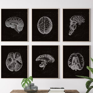 black and White Anatomy, Radiology Art Print, Human Brain Art, Medical Art, Nervous System, Neurological Art, Doctor Office Art, Clinic Art