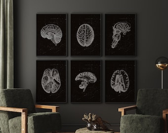 Anatomie noir et blanc, Impression d’art radiologie, Art du cerveau humain, Art médical, Système nerveux, Art neurologique, Art de bureau de médecin, Art clinique