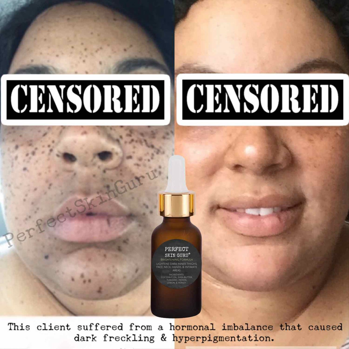 GET 2 SERUMS Special Discount Dark Inner Thighs Dark | Etsy