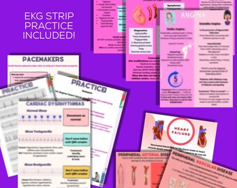 Medsurg Cardiac with EKG strip practice! | 14 pages