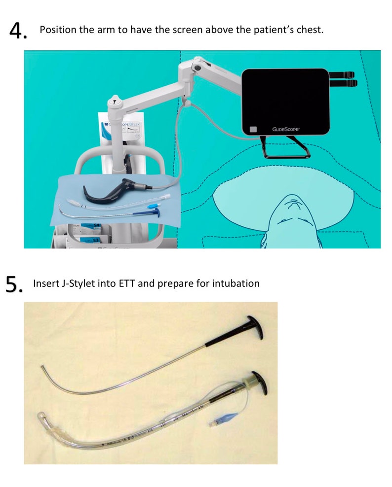 Glidescope Set up Guide Etsy