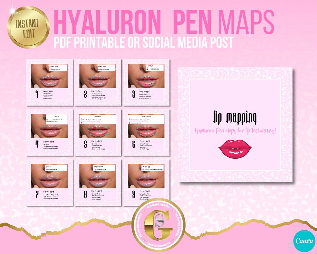 Hyaluron Pen Lip Maps Lip Mapping Guides Techniques Russian Etsy