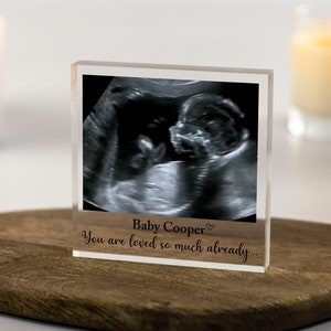 Pregnancy Scan Photo Frame, Baby Scan, Baby Shower Gift, Grandparents to be Gift, Ultrasound Pregnancy Scan Print, Pregnancy Announcement