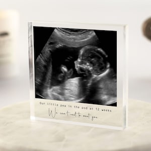Baby Scan Photo Print, Baby Scan Keepsake, Baby Shower Gift, Baby Scan Gift, Ultrasound Print, Pregnancy Scan Print, Pregnancy Announcement