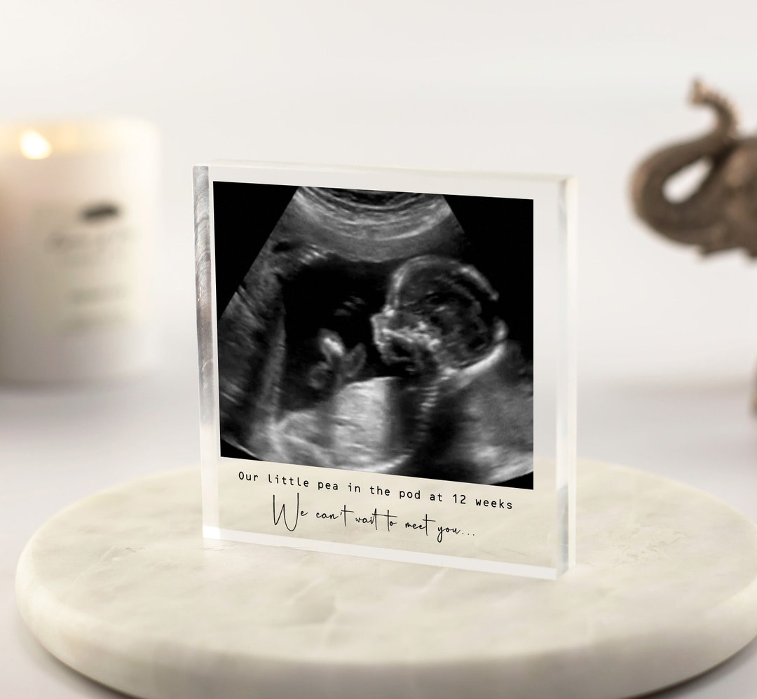 Baby Scan Photo Print, Baby Scan Keepsake, Baby Shower Gift, Baby Scan