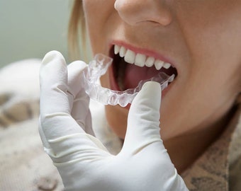 Puede incluir: Primer plano de la boca de una persona con un alineador transparente de plástico que se coloca sobre los dientes.