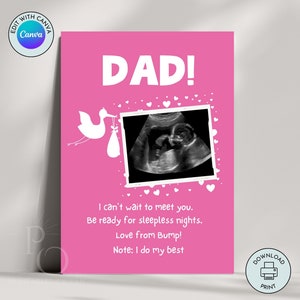 Annuncio di gravidanza personalizzato per la nuova nascita Carta di scansione Stampabile Bambino Rivela Idea a sorpresa Scheda di bambino in arrivo Scheda in attesa Bambino non ancora nato