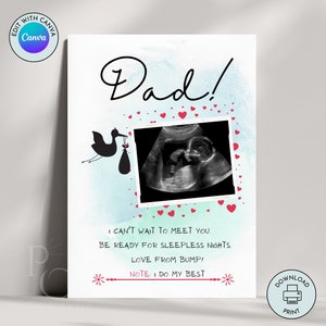 Annuncio di gravidanza personalizzato per la nuova nascita Carta di scansione Stampabile Bambino Rivela Idea a sorpresa Scheda di bambino in arrivo Scheda in attesa Bambino non ancora nato