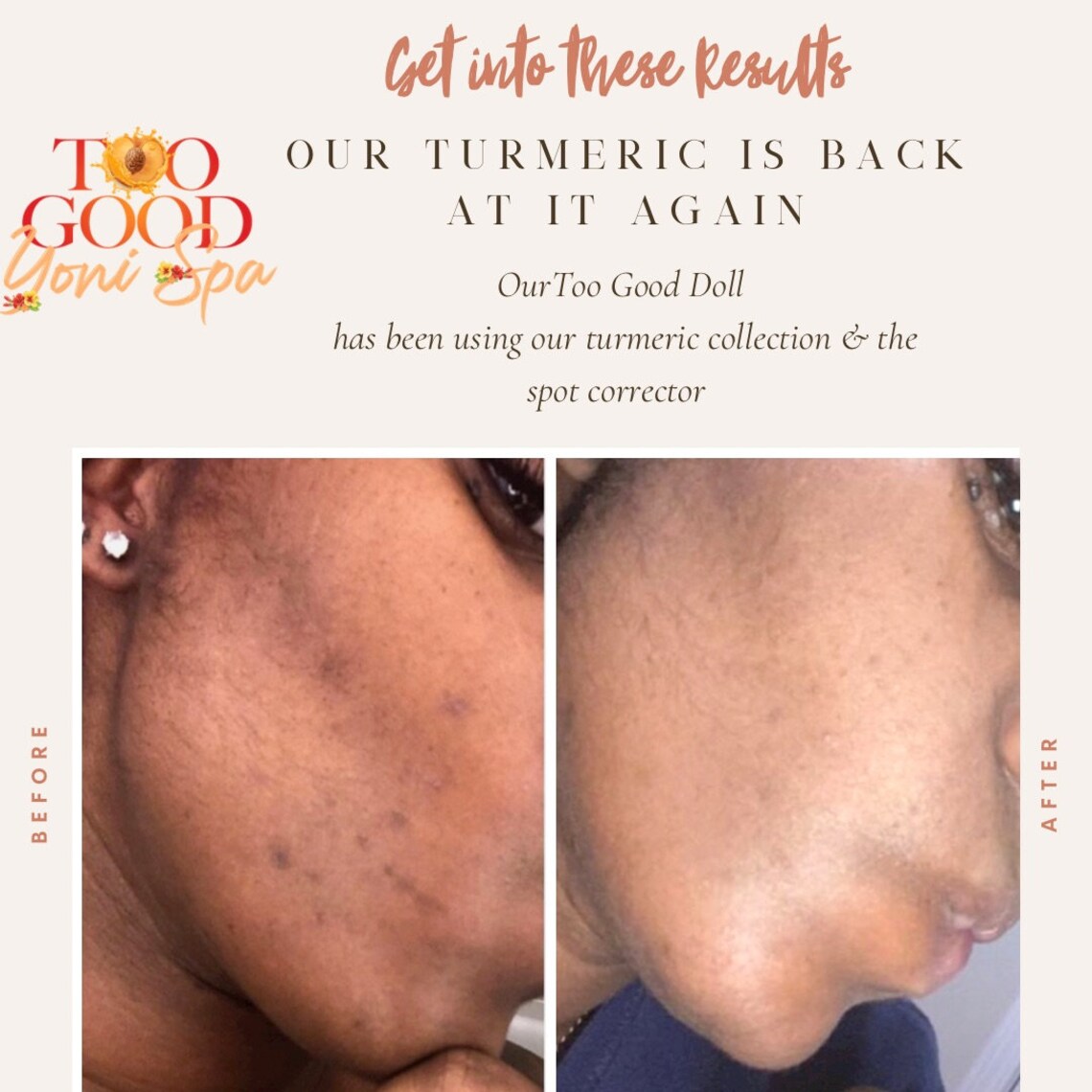 Turmeric Brightening Soap Etsy