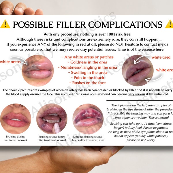 A6 Aesthetics Dermal & Lip Filler Complications Cards for Clients - DOWNLOAD ONLY (white)