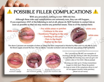 A6 Aesthetics Dermal & Lip Filler Complications Cards for Clients - DOWNLOAD ONLY (white)