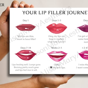 A3 Aesthetics &#39;Lip Filler Journey&#39; for Clients - DOWNLOAD ONLY