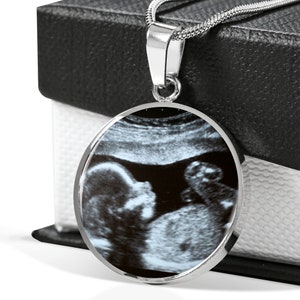 May include: A silver necklace with a round pendant featuring a black and white ultrasound image of a baby.