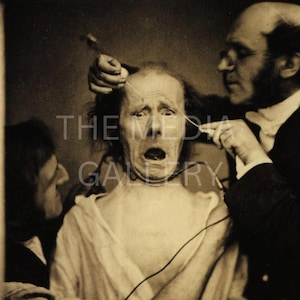 Victorian Scientific Experiment Subject, 1850s Photo Print - Vintage Old Photo - 19th Century - Gothic Art - Creepy Photo - Macabre Art