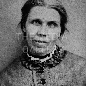 Woman in Victorian Insane Asylum, 1869 Photo Print - Vintage Old Photo - 19th Century - Gothic Art - Creepy Photo - Macabre Medical Art