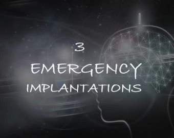 Emergency 3 Implantations