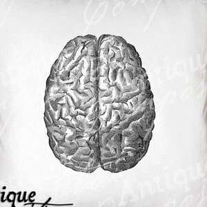 Gehirn Clip Art - Vintage Menschliches Gehirn druckbar - Gehirn Sublimation - Antiker Chemotherapie Kunstdruck