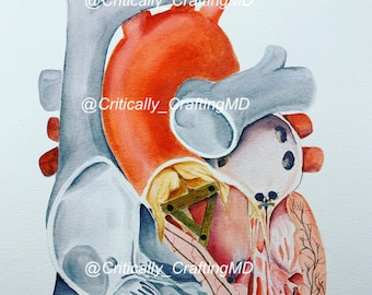 Structural Heart