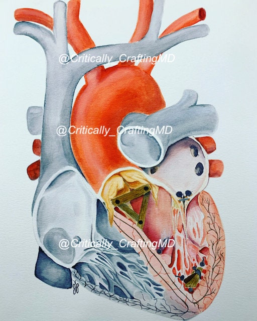 Structural Heart