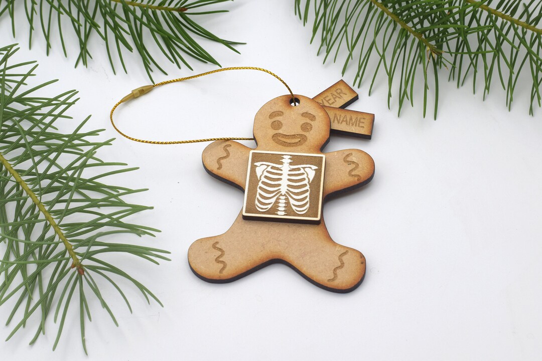 X-ray Gingerbread Man Ornament Radiology Xray Tech Radiologic ...