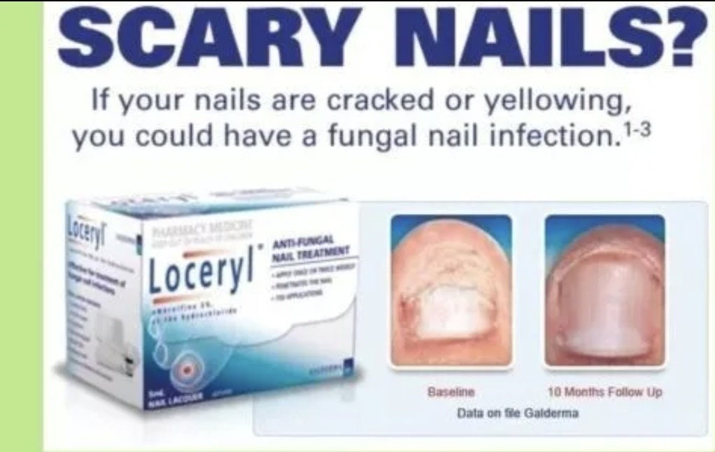Loceryl Nail: Uses, Price, Dosage, Side Effects, Substitute, Buy Online