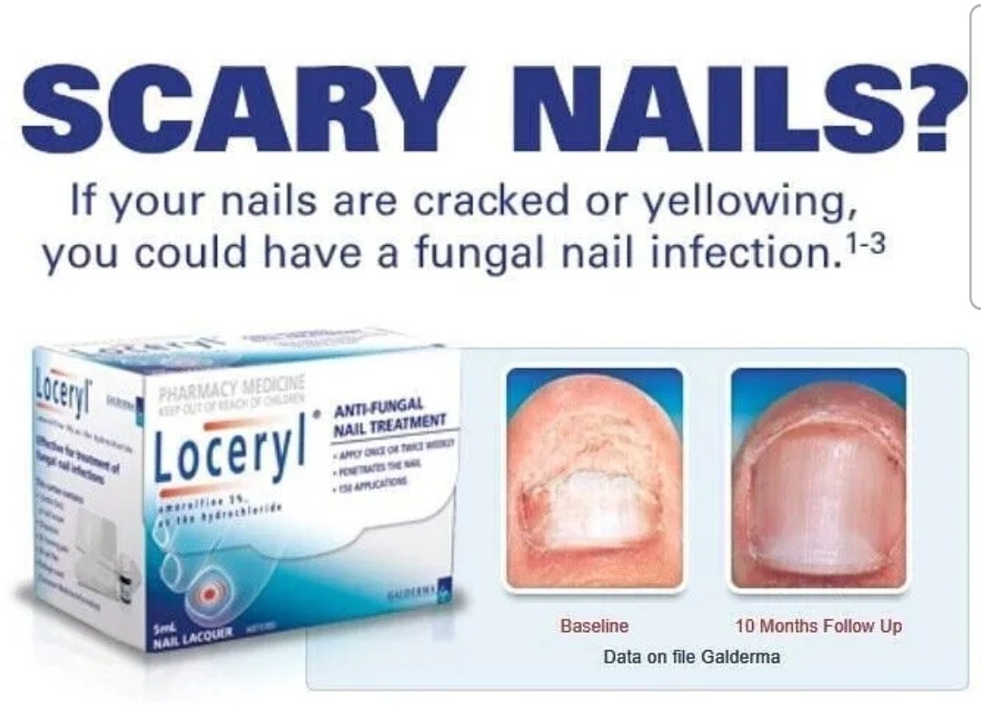 Loceryl nail lacquer buy online, side effects, price, reviews | Great Pharma