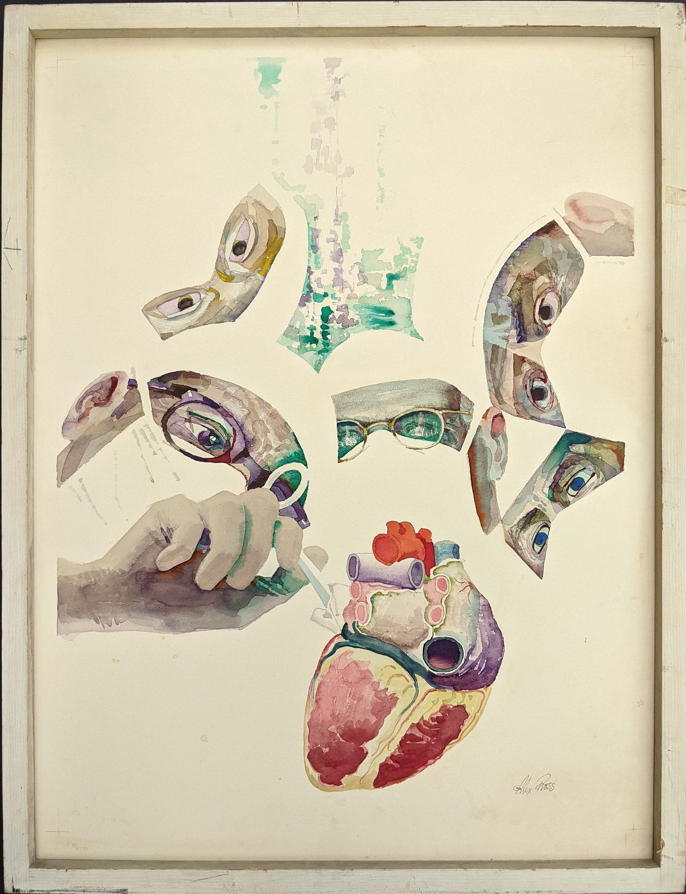 Vintage Original Watercolor Painting of Doctors Performing Heart Surgery by Alex Ross - Watercolor on Board - Published Magazine Cover
