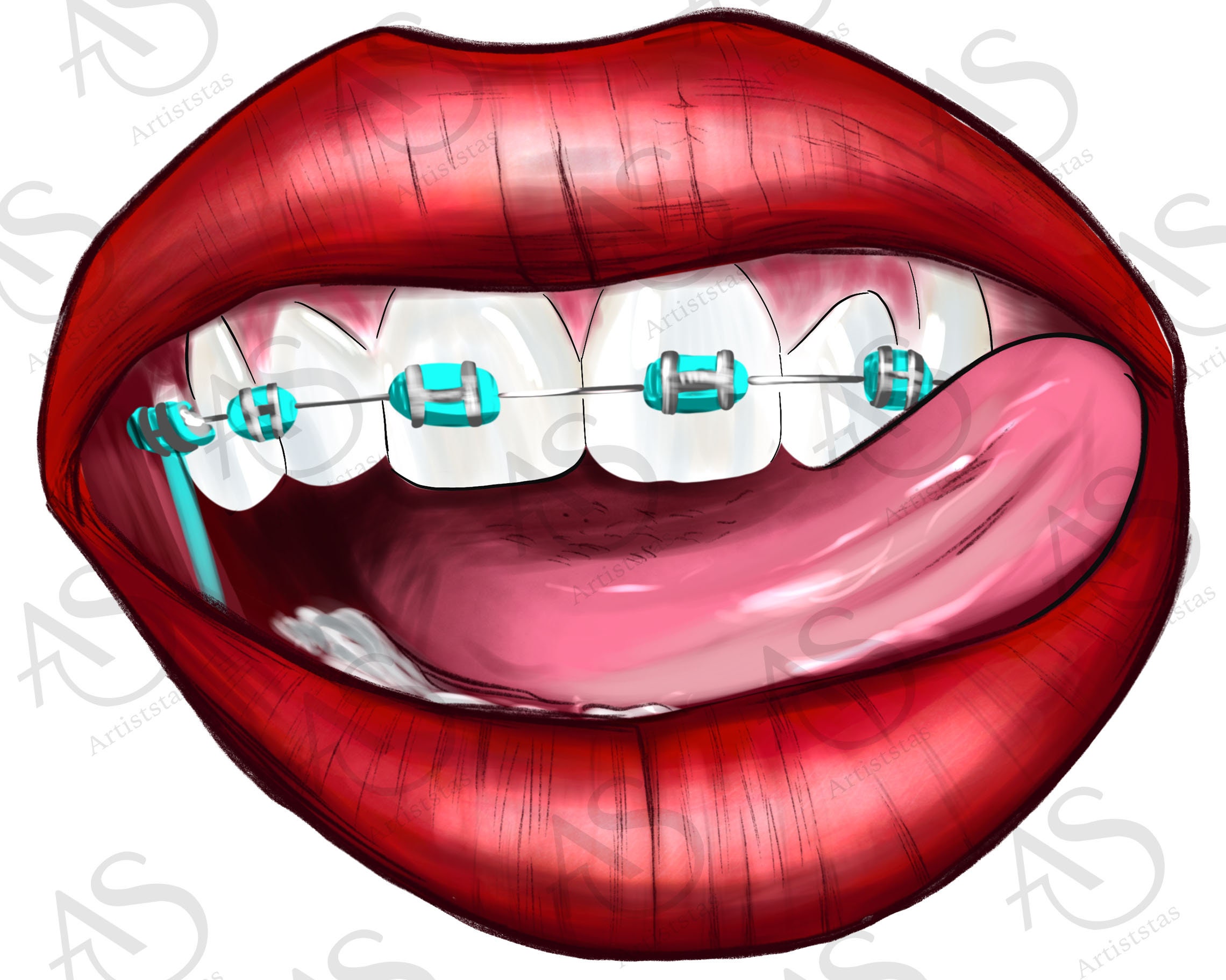 Dental Braces Clipart Free