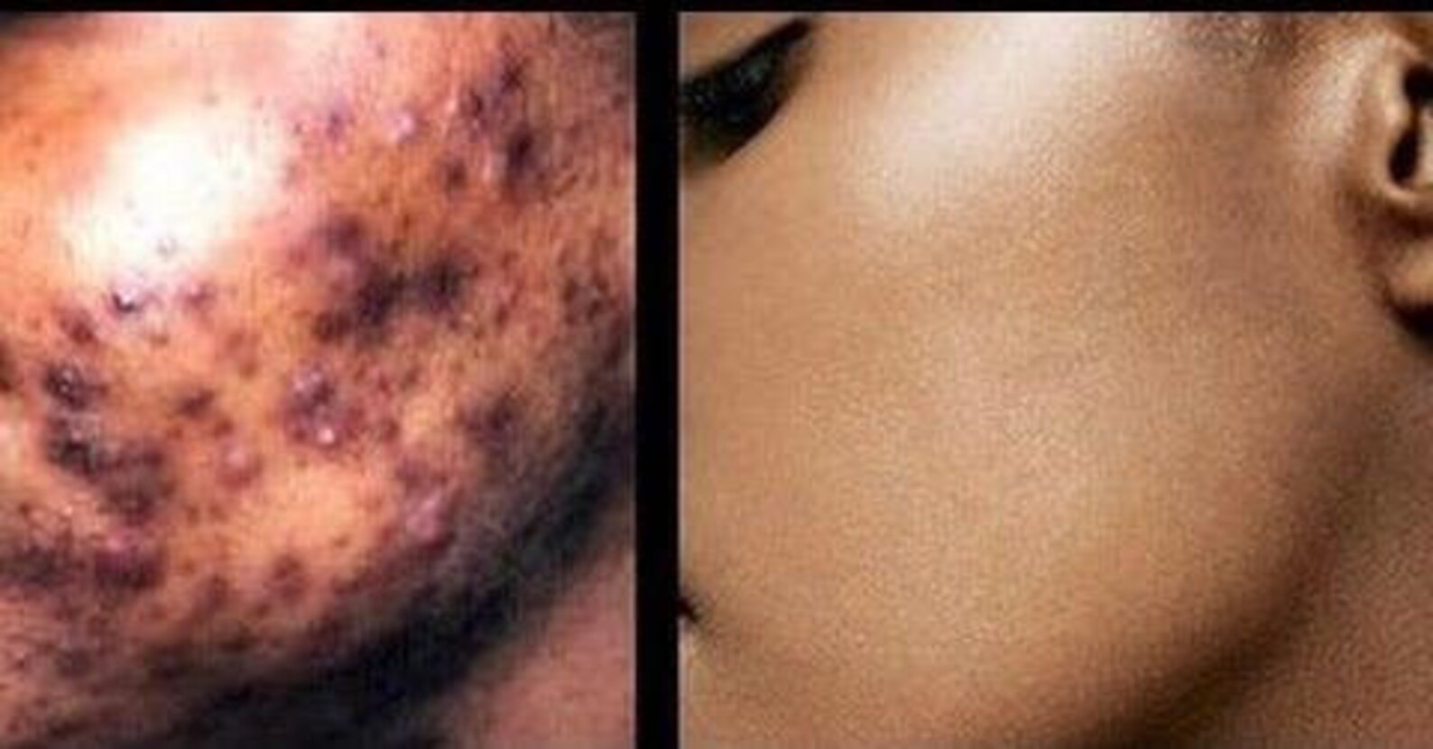 4oz. Skin Discoloration & Blemishes Dark Spot Remover Cream | Etsy