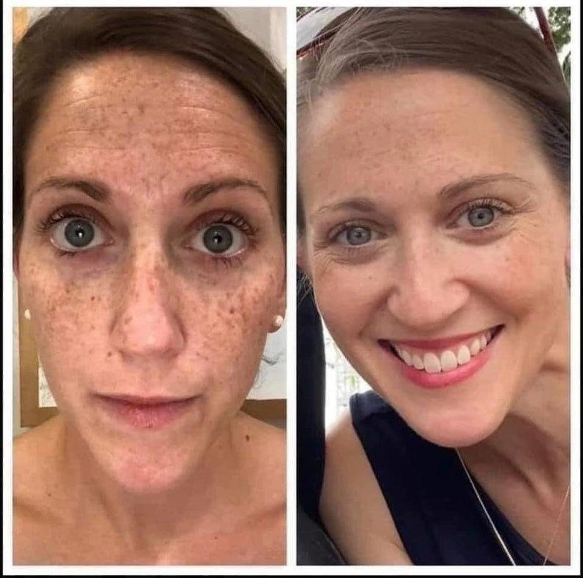 180 Face Wash Effective Vitamin C Evens Skin Tone Erase Etsy