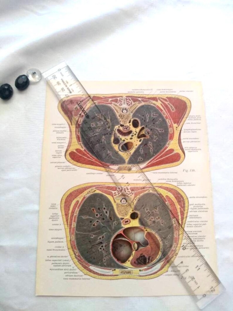 Vertical Dissection Horizontal Vertical Abdomen Diagram Dissection Anatomy Drawing Vintage ...