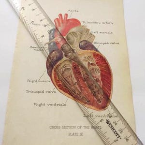 Querschnitt der Herz-Platten-Druck-Erkrankung Medizinische Buchbibliothek Vintage Antique Handbuch Nachschlagebuch Rahmung Seltsames Geschenk Horror Dekor