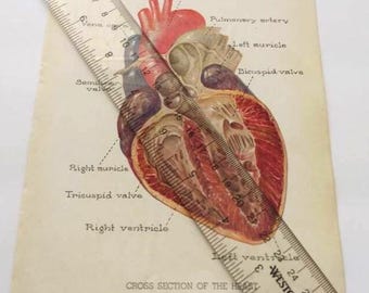 Querschnitt der Herz-Platten-Druck-Erkrankung Medizinische Buchbibliothek Vintage Antique Handbuch Nachschlagebuch Rahmung Seltsames Geschenk Horror Dekor