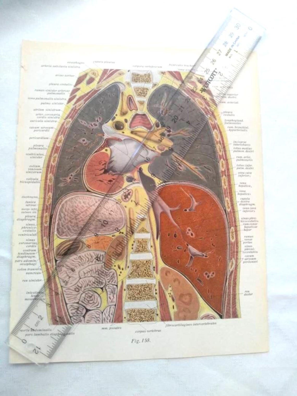 Vertical Dissection Horizontal Vertical Abdomen Diagram Dissection Anatomy Drawing Vintage ...