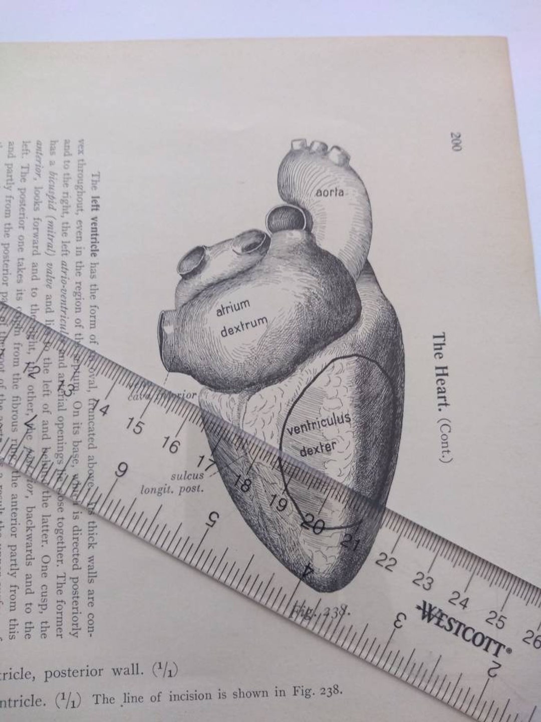 Heart Cross Section Diagram Dissection Anatomy Drawing Vintage - Etsy