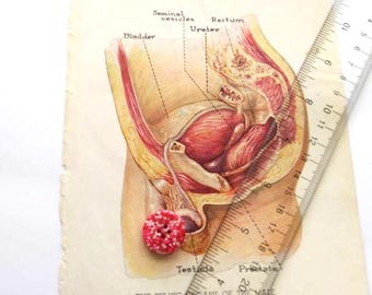 Beckenorgane des Mannes Plattendruck Infektion Medizinische Buchbibliothek Vintage antikes manuelles Nachschlagewerk Rahmen seltsames Geschenk Horror Dekor