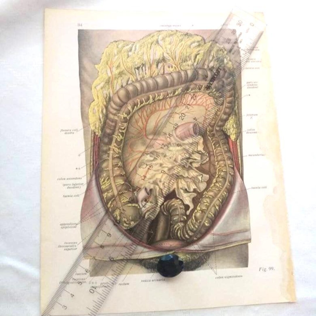 Colon and Other Bit Diagram Dissection Anatomy Drawing Vintage Medical ...