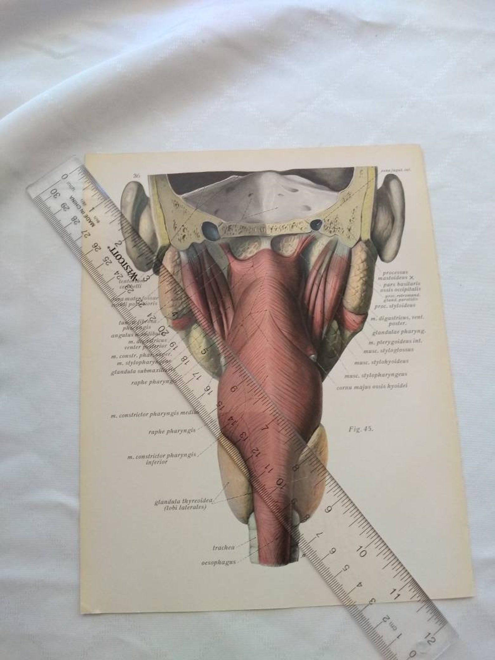 Underside and Back Side of Head Diagram Dissection Anatomy Drawing